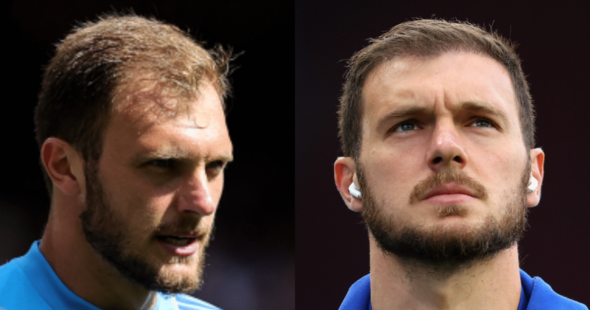 Transplante Capilar de Lucas Perri Impressiona pela Naturalidade; Dr. Felipe Blanco Analisa o Processo